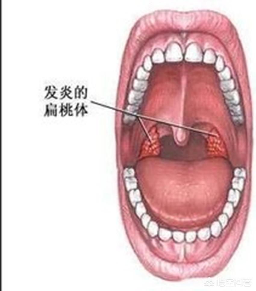 今日科普一下！近期流感99%是甲流,百科词条爱好_2024最新更新